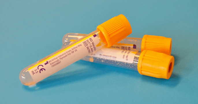 https://www.apollohealthco.com/wp-content/uploads/p-tau-217-686x360.png