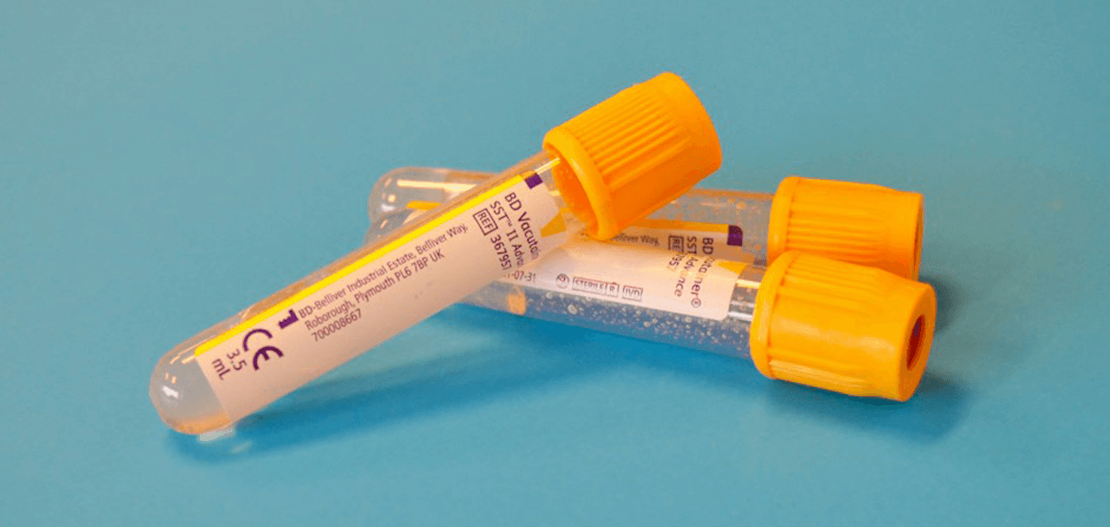 https://www.apollohealthco.com/wp-content/uploads/p-tau-217.png